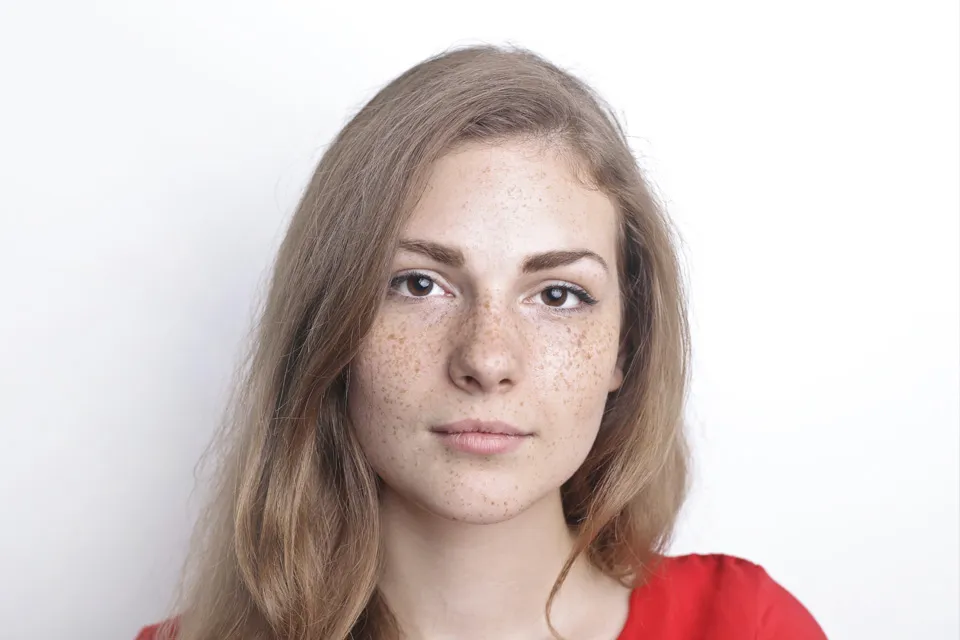 そばかすが魅力的な女性