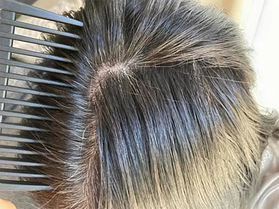 髪がプリンになっている人の写真