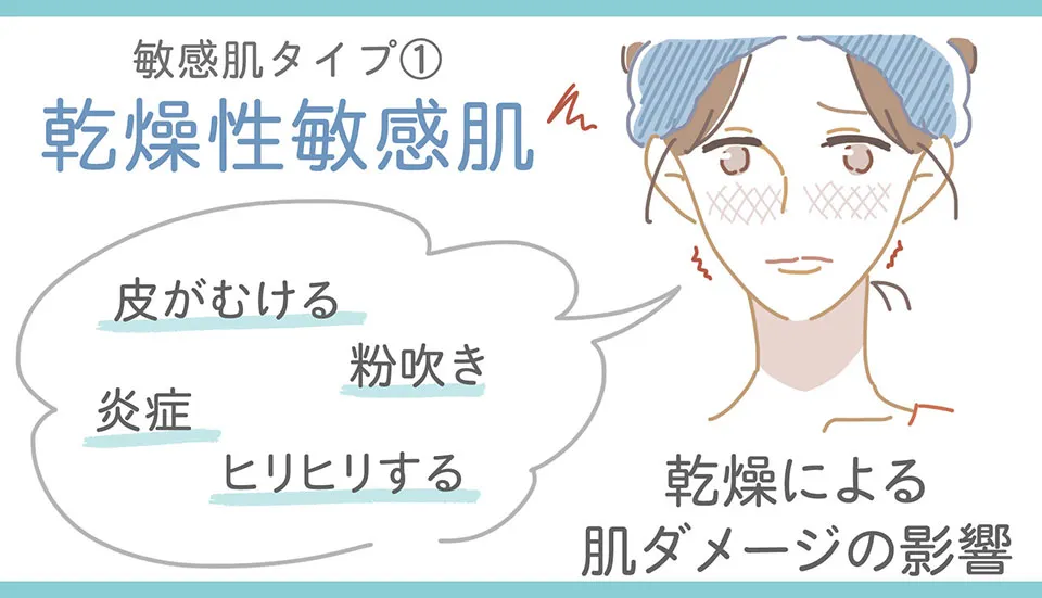 乾燥性敏感肌の説明イラスト