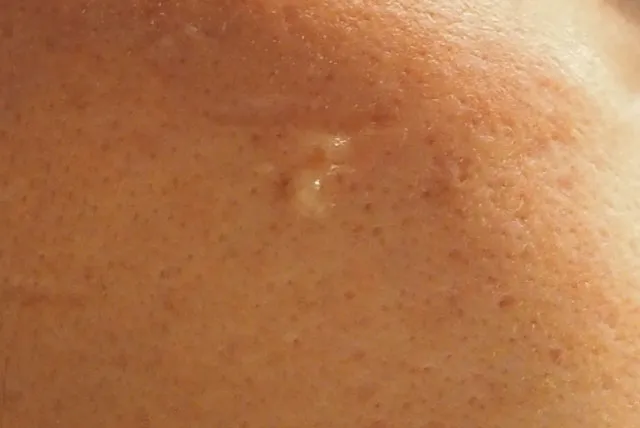 ピンポイントで使用