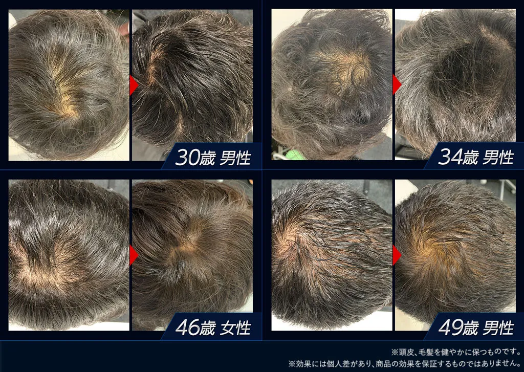 3ヶ月利用後の状態