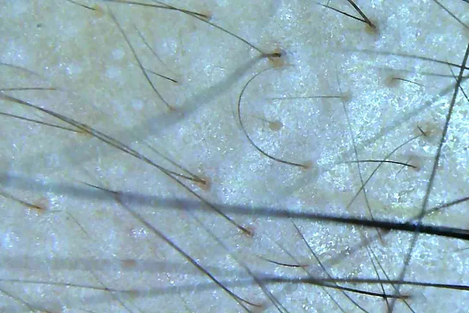 頭髪をマイクロスコープでチェック