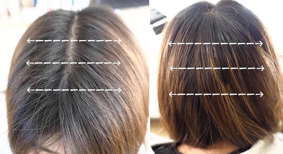 ルルシアを塗布する前頭部と後頭部の写真