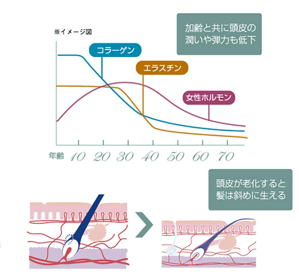 薄毛の原因画像