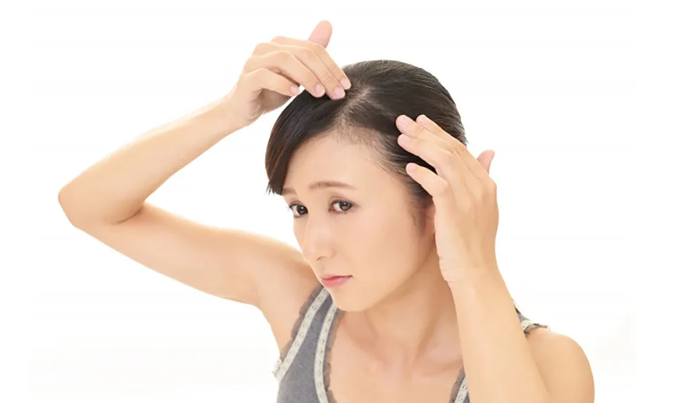 薄毛に悩む女性写真