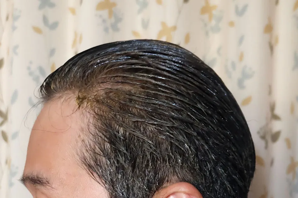 白髪を男性が染めている写真