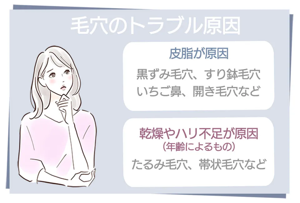 毛穴トラブルの原因を解説するイラスト