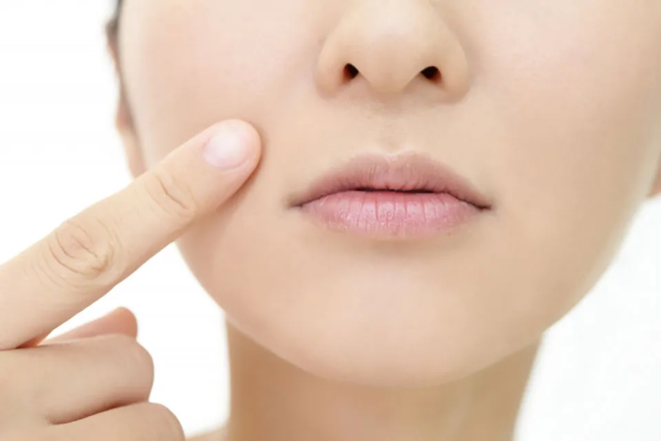 ほうれい線を気にする女性の写真