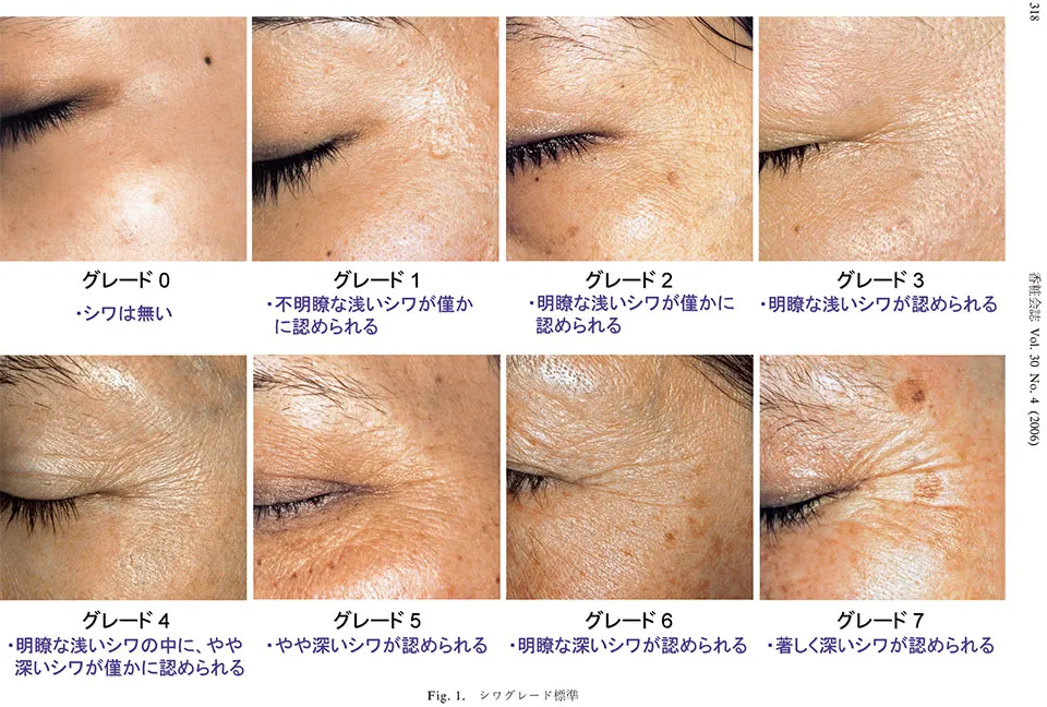 シワグレード写真