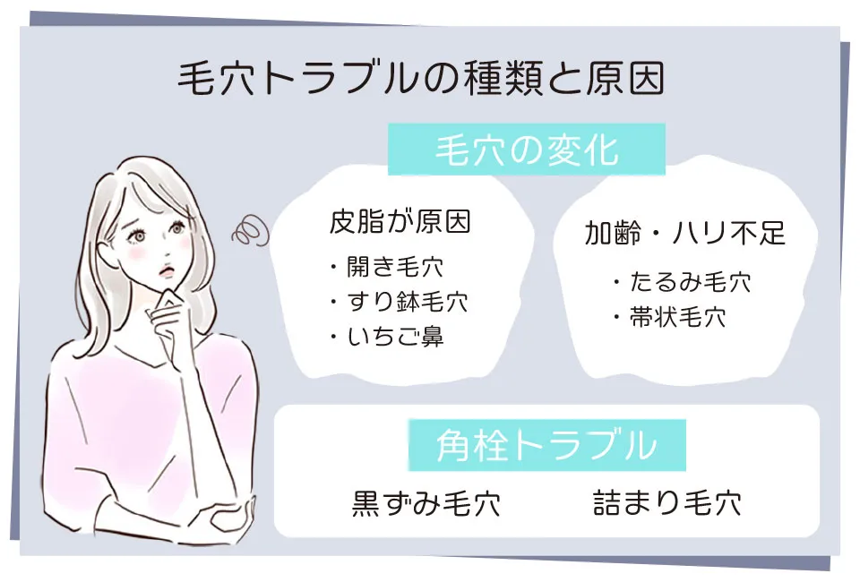 毛穴トラブルの種類と原因