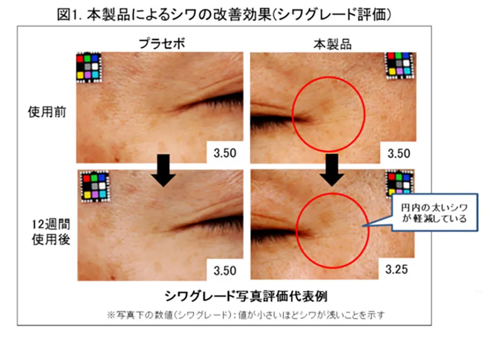 ニールワンシワ改善効果解説シワグレード写真