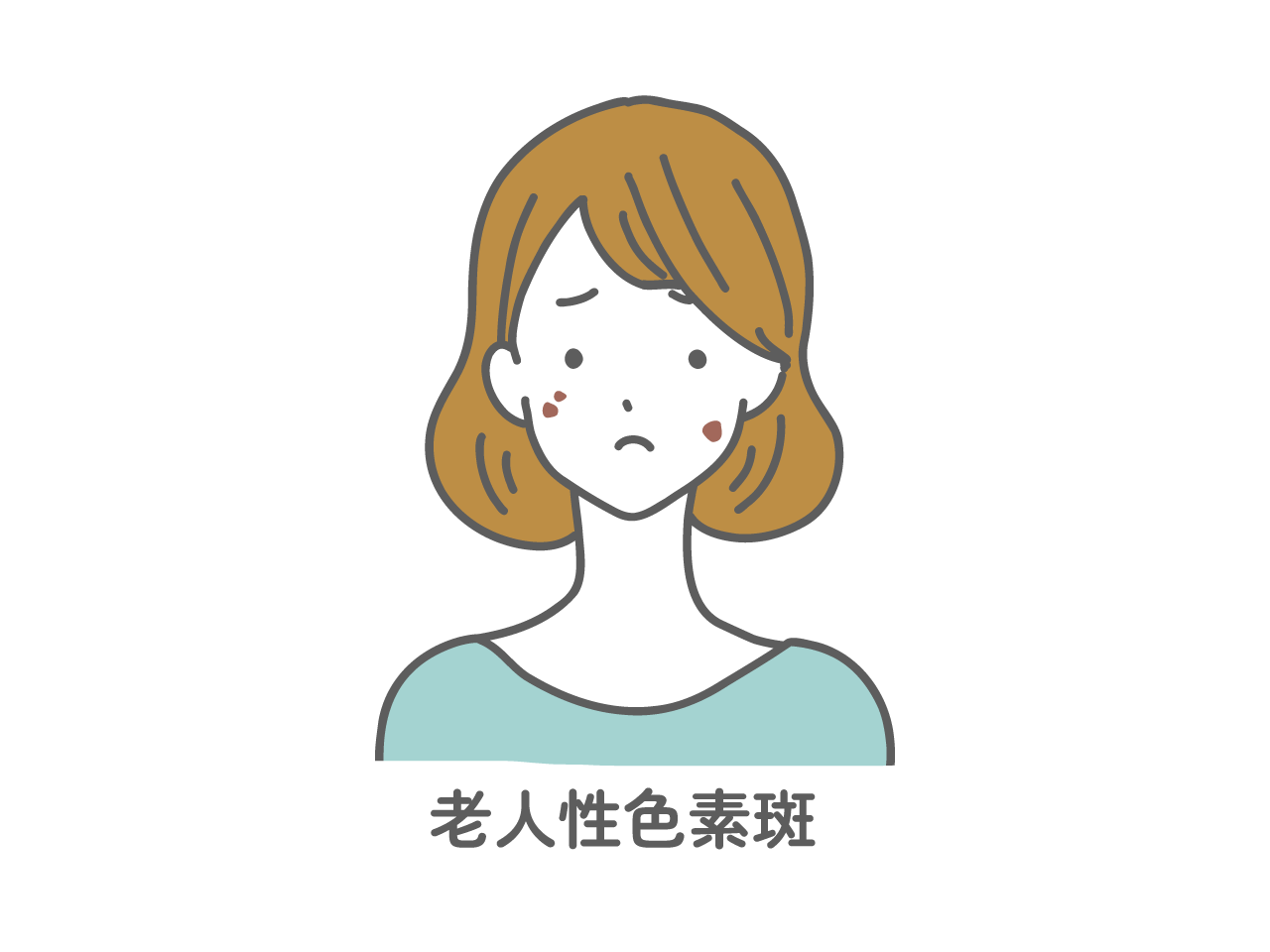 老人性色素斑