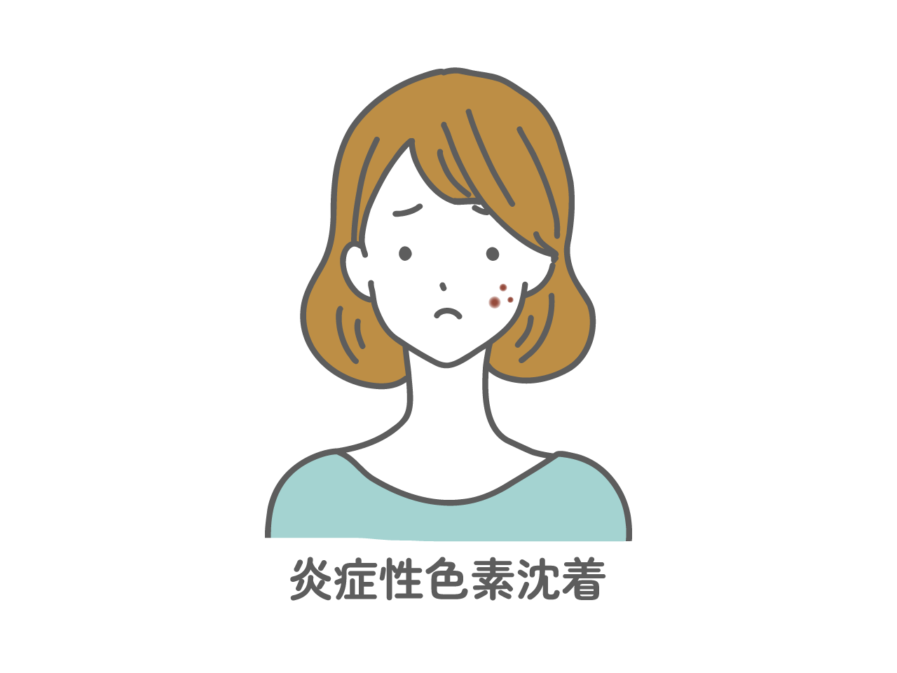 炎症性色素沈着