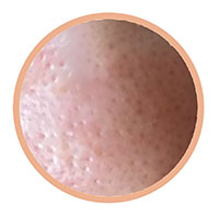 毛穴に効くおすすめ化粧水ランキング18選 角栓 すり鉢毛穴をプチプラで改善 Roccogirl