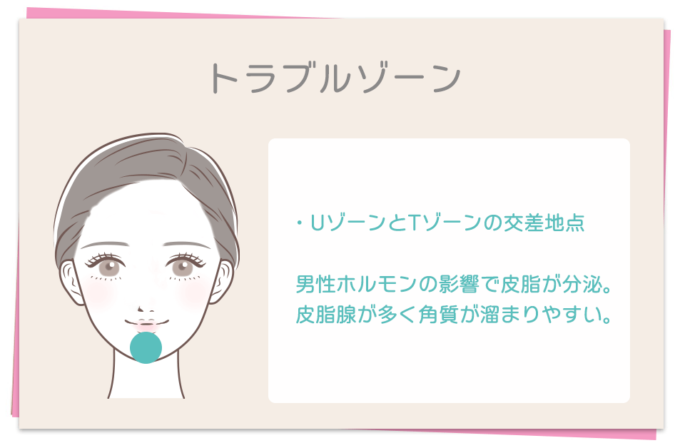 トラブルゾーン