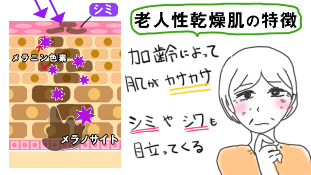 老人性乾燥肌の特徴