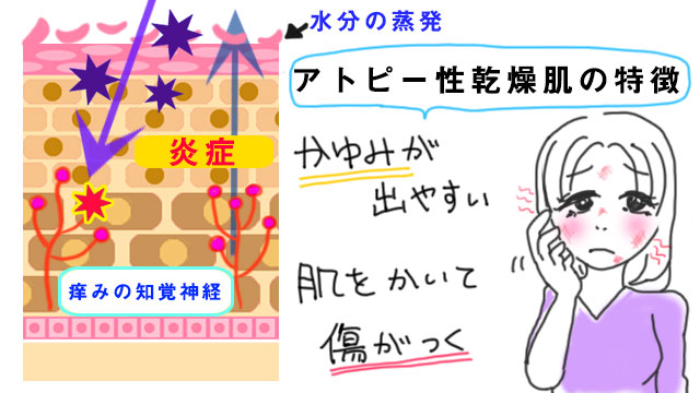 アトピー性乾燥肌