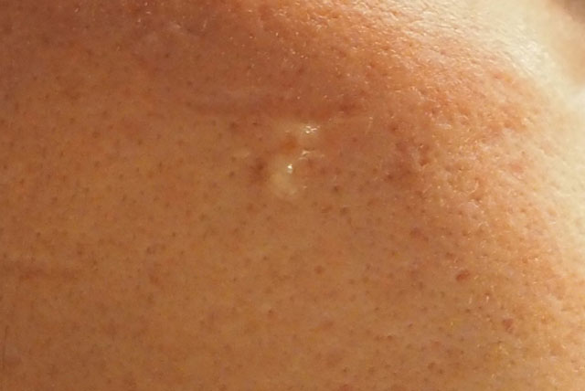 ピンポイントで使用