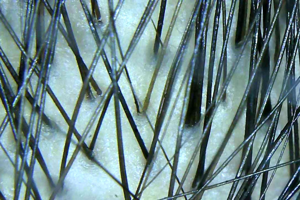 マイクロスコープで毛の太い部分をチェック