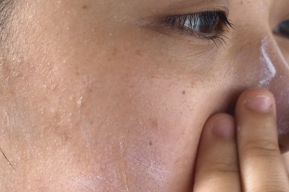 額や鼻などに伸ばしていきます