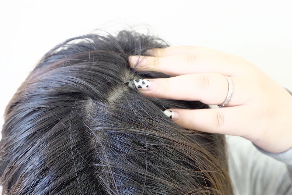 育毛剤をなじませている写真