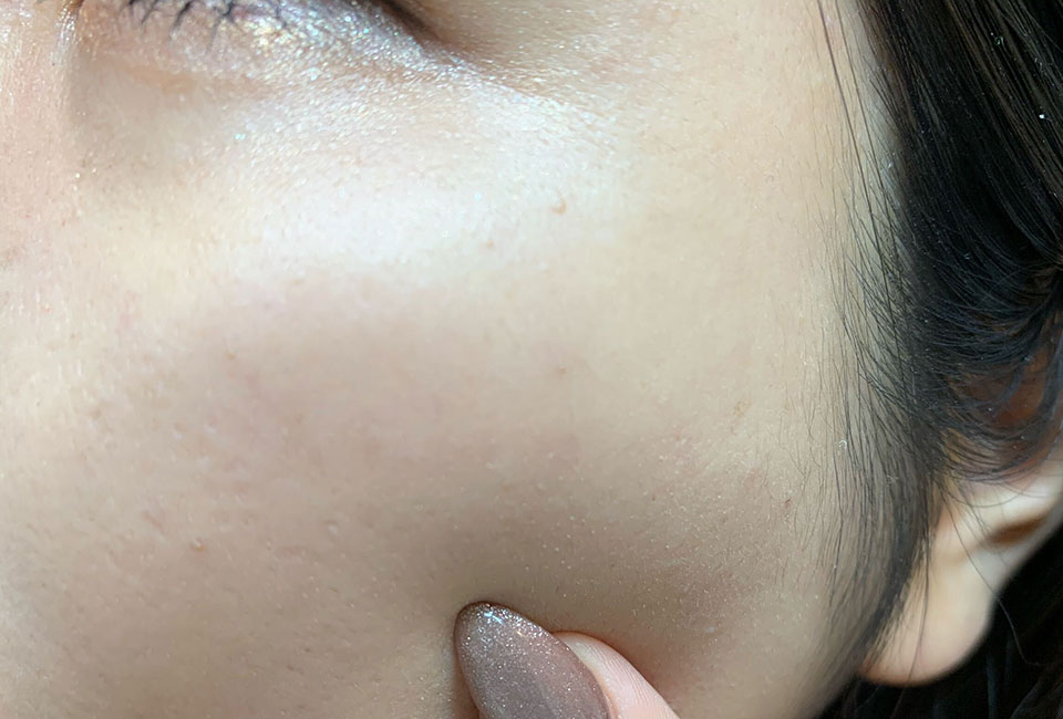 イニクスファンデーションを使用した肌の画像