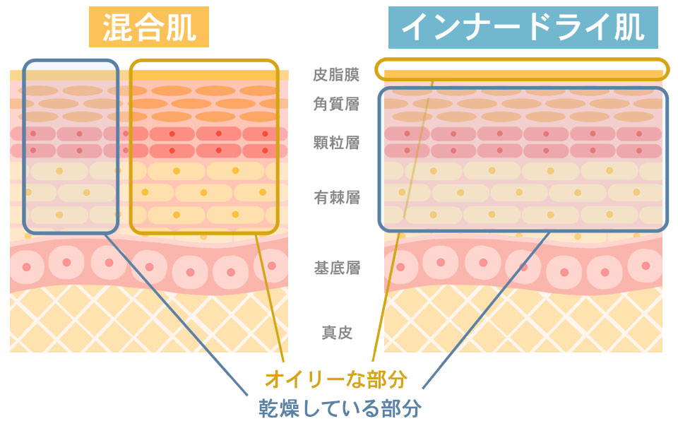 インナードライと混合肌の違いをイラストにしたもの