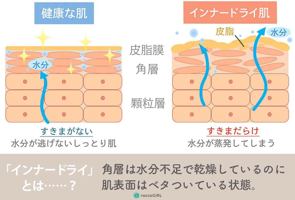 インナードライとは？