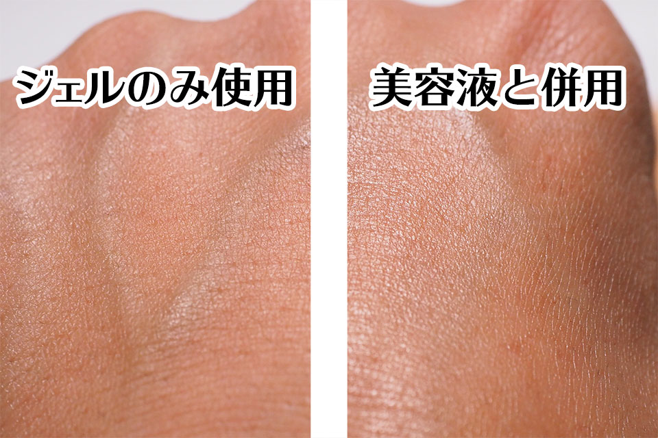 美容液併用した時とジェルのみ使用した時の肌質を比較