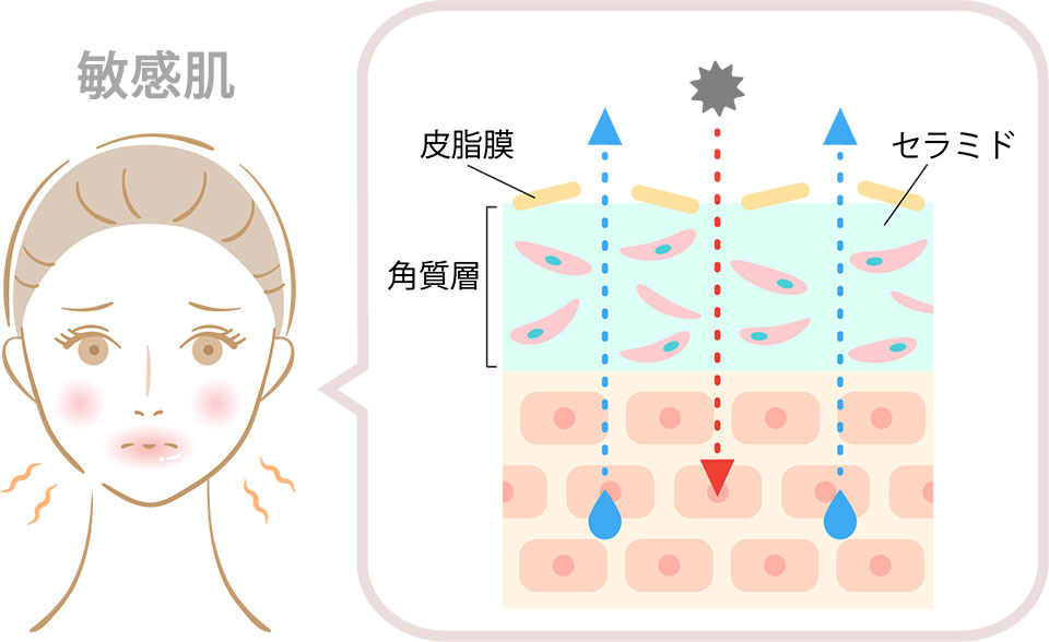 敏感肌女性の解説イラスト