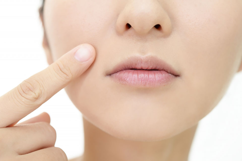 ほうれい線を気にする女性の写真