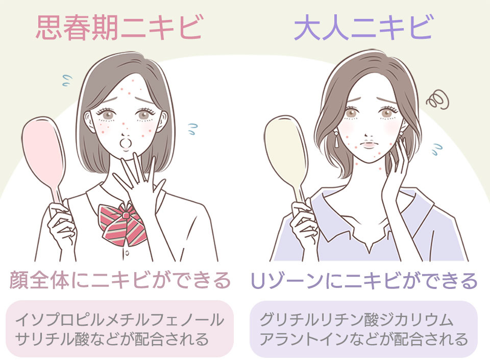 思春期ニキビと大人ニキビの化粧品に配合される成分の比較と女性のイラスト