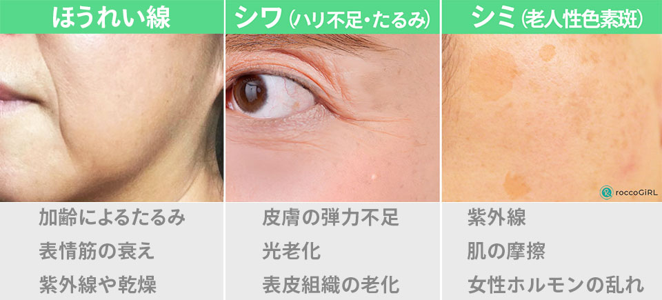 肌悩み症例写真